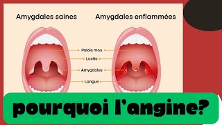 Pourquoi tu as l’angine  Douleur à la gorge et le traitement [upl. by Buroker]