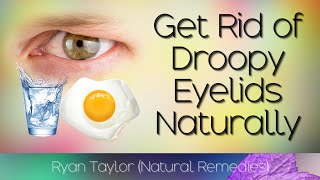 How To Lift Droopy Eyelids Naturally [upl. by Jat]