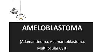 Ameloblastoma  Clinical Features and Treatment of Ameloblastoma [upl. by Eerat792]