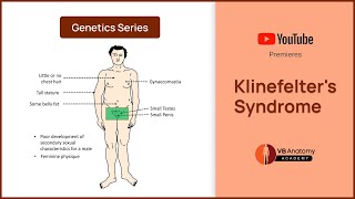 Klinefelters Syndrome Explained Genetics Characteristics and Complications [upl. by Yrtnej936]