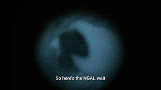 Invisiblesight NGAL VS MAWL C1 VS LA5 PEQ 15 [upl. by Tess]