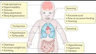 Neonatal Adaptation Syndrome  Dr Kumar Ankur [upl. by Lotte]