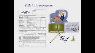 FALL RISK ASSESSMENT FOR OSCE [upl. by Hillman]