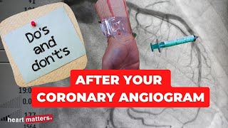 Post your coronary angiogram  What to know [upl. by Chandless]