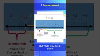 TScore Explained [upl. by Irihs]