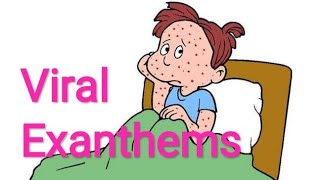 Viral Exanthematous Infections  Rashes  MICROBIOLOGY  Measles  Small Pox  Chicken Pox Viruses [upl. by Hodgkinson700]