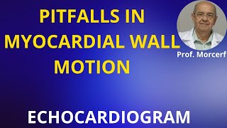 Tips for Better LV Endocardial Identification [upl. by Eatnod]