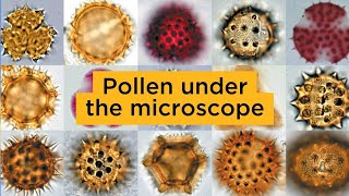 Pollen under the microscope [upl. by Panayiotis]