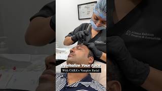 PRP Treatment For Face  Vampire Facial To Revitalize Face at CARA [upl. by Ahsiri428]