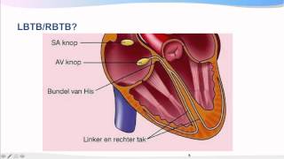 Introductiecursus ECG interpretatie [upl. by Anaehr201]