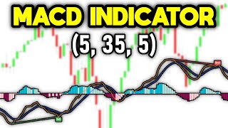 MACD Indicator Settings Revealed 5 35 5 [upl. by Martguerita]