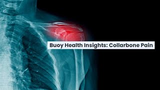 Collarbone Pain Common Causes and When to Seek Medical Care  BuoyHealthcom [upl. by Zedecrem]