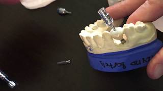 Restoring Neodent implant level impressions [upl. by Notlit530]