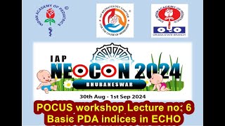 IAPNEOCON2024 POCUS workshop Basic PDA indices in ECHO [upl. by Fowler]