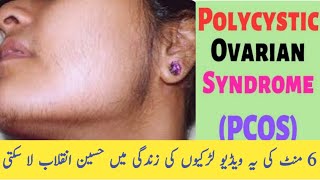 A to Z About PCOS  Treatment Of PCOS  DR SHAHZAD HASHMI [upl. by Alenairam]