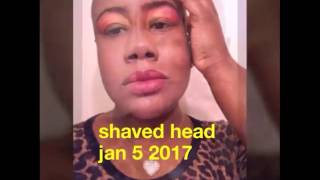 A SEW IN WEAVE ON A BALD HEAD SEE IT 2 BELIEVE IT NOT CLICK BAIT [upl. by Ateikan536]