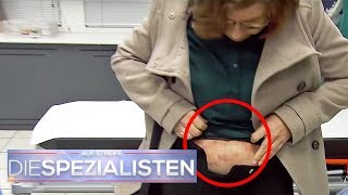 Ekelig Patienten haben juckende Milben unter der Haut  Die Spezialisten  SAT1 TV [upl. by Arhsub506]