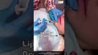 Lip Fillers Tailored to Your Perfect Pout  Dr Shumaila Khan [upl. by Bernhard329]