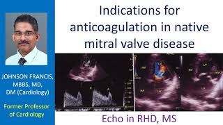 Indications for anticoagulation in native mitral valve disease [upl. by Rexer680]