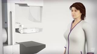 Mammogram for Breast Cancer  What to Expect [upl. by Assirahs]