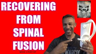 TLIF Fusion Surgery Recovery L4 L5 Week 1𝐘𝐎𝐔 𝐍𝐄𝐄𝐃 𝐓𝐇𝐄𝐒𝐄 𝐆𝐀𝐃𝐆𝐄𝐓𝐒 [upl. by Therron]