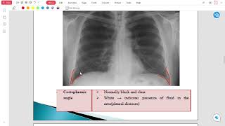 Radiology Lec 2 [upl. by Llenoil26]