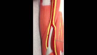 Brachial Plexus Anatomy on Model [upl. by Jammie828]