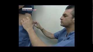 Lipolyse de labdomen par le Docteur Thierry LAFITTE TV5 Mondemp4 [upl. by Feriga]