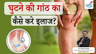 क्यों होती है घुटनो में गांठ और उसका कैसे करे इलाज  Baker Cyst treatment  SAAOL Ortho Care [upl. by Beasley]