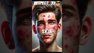 Face problems 6 step shorts comedy funny viralvideo ai skincare rescpect [upl. by Gentry]