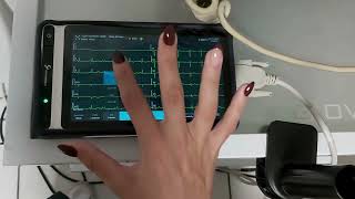 NeoECG S120 Demonstrated by Cardiologist [upl. by Notselrahc]