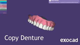 Exocad Copy Denture Tutorial [upl. by Dric912]