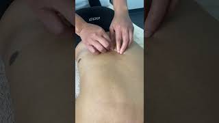 Myofascial release techniques myotherapy myofascialrelease [upl. by Havener966]