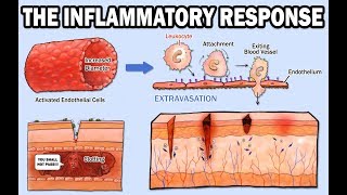 THE INFLAMMATORY RESPONSE [upl. by Dreddy]