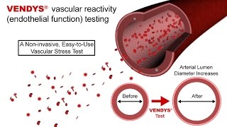 VENDYS  Endothelial Function Measurement Explained [upl. by Anatniuq]