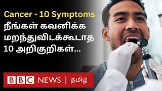 Cancer 10 Symptoms இதை சீக்கிரம் கவனிச்சிட்டா Treatment மூலம் குணப்படுத்திவிடலாம் [upl. by Hama]