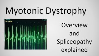 Myotonic Dystrophy and Spliceopathy explained [upl. by Simonsen]