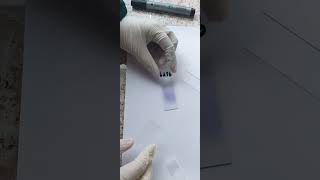 Learn to prepare a slide for reticulocyte count in less than 3 minutes [upl. by Nnayt]