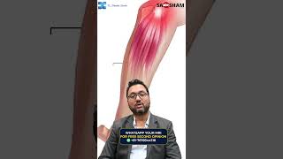 Treatment for Inflammatory Arthritis 🏥  Dr Debashish Chanda [upl. by Anidan]