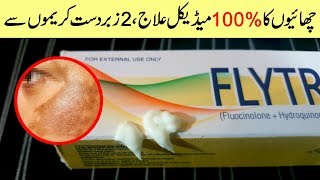 Remove Freckles amp Melasma on Face with Hyderquin Plus amp Flytro Cream Urdu Hindi [upl. by Atterehs]