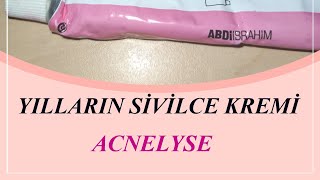 ACNELYSE KREM YILLARIN SİVİLCE KREMİ [upl. by Nivloc]