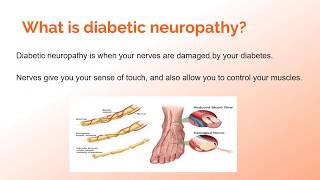 Diabetic Neuropathy An Introduction [upl. by Guilbert618]