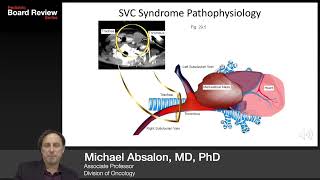 Oncology  Oncologic Emergencies 2019 Board Review Series [upl. by Ylsew]