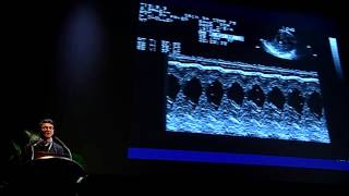 ECHOCARDIOGRAPHIE PERI OPERATOIRE [upl. by Acinimod]