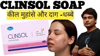 clinsol soap  clinsol soap review in hindi  clinsol soap review  clinsol soap ke fayde [upl. by Alehtse]