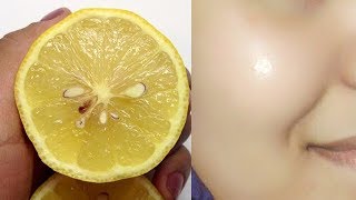 नीम्बू से पाइए रातो रात गोरी निखरी त्वचा How To Do Lemon Facial At Home To Get Fair Skin [upl. by Hercule]