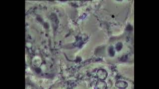 Periodontitis biofilm pathogen Amoebae Multiple Phagocytosis Courtesy Dr R [upl. by Sulohcin783]