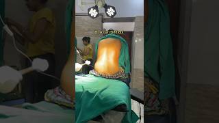 Spinal Anesthesia  How to give Spinal Anesthesia  Dr Aman Siddiqui  anaesthesia  spinal [upl. by Dupuis604]