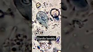 Giardia lambliaGiardiasis parasiteparasite under microscope microscopy parasitology [upl. by Namso101]