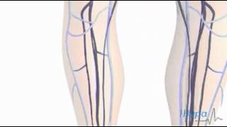 How superficial thrombophlebitis develops [upl. by Aroel]